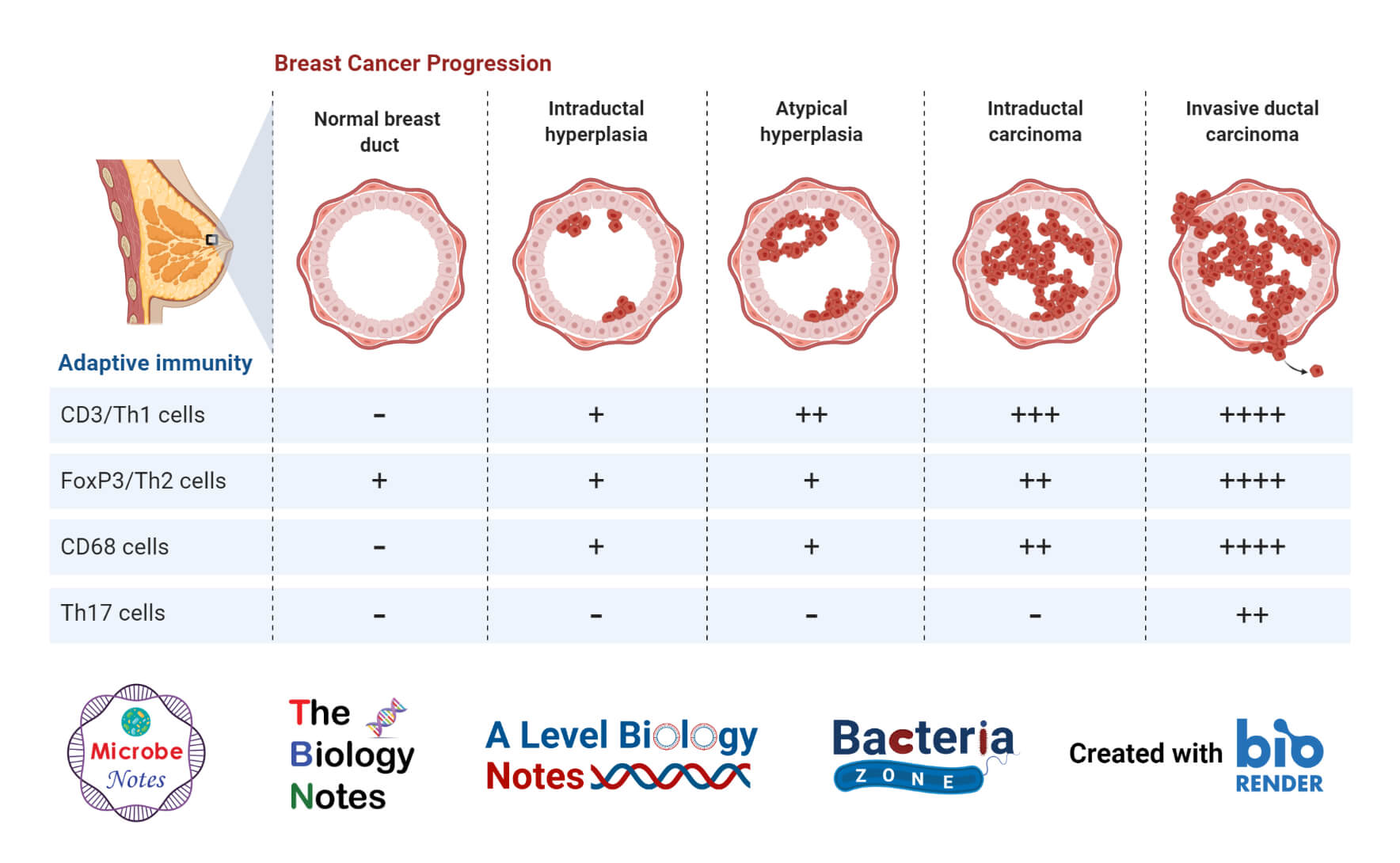 Adaptive Immunity During Breast Cancer Progression