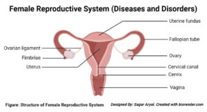 Diseases and Disorders of the female reproductive system