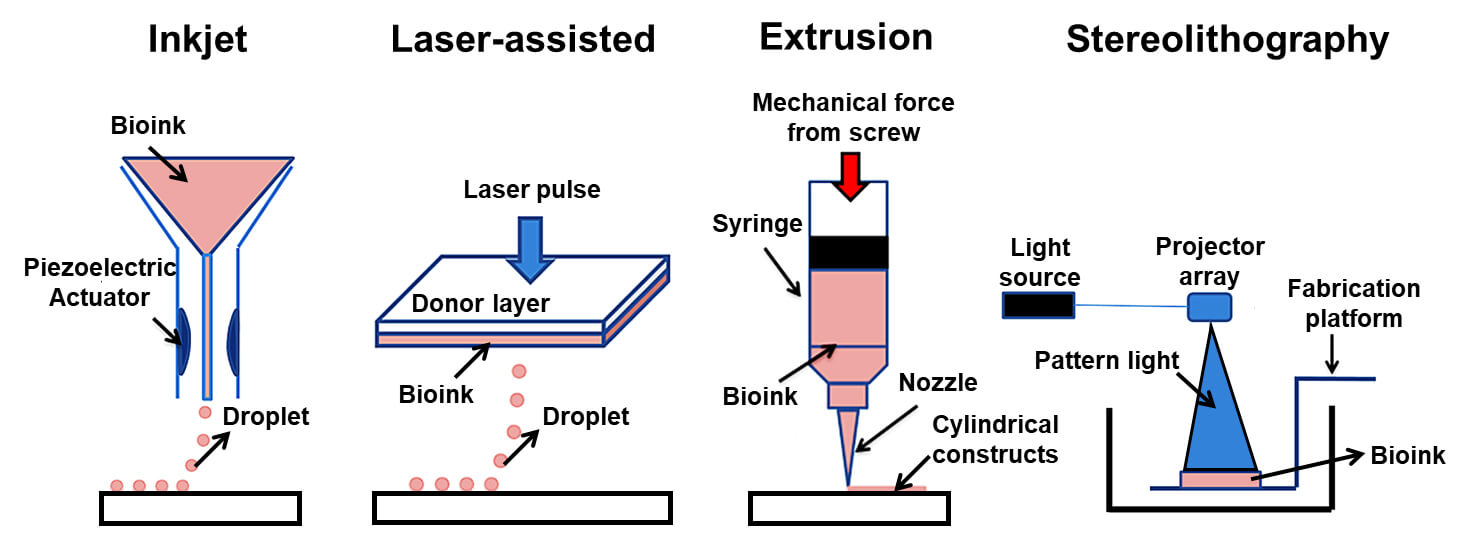 3D Bioprinting Technology (Types)