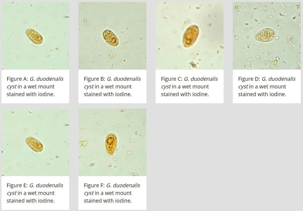 giardia cysts in stool images