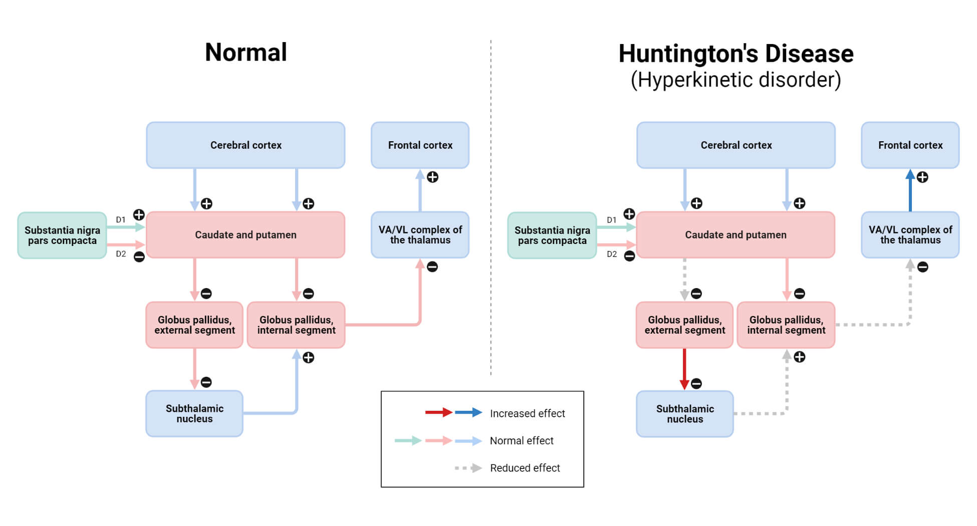 Huntington's Disease (Hyperkinetic Disorder)