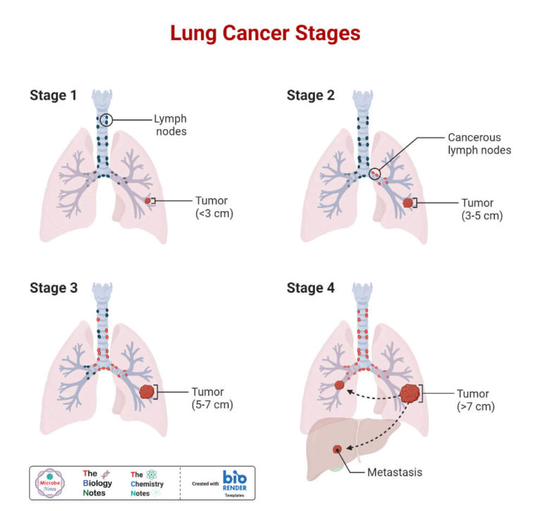 Lungs- Definition, Structure, Location, Functions, Diseases