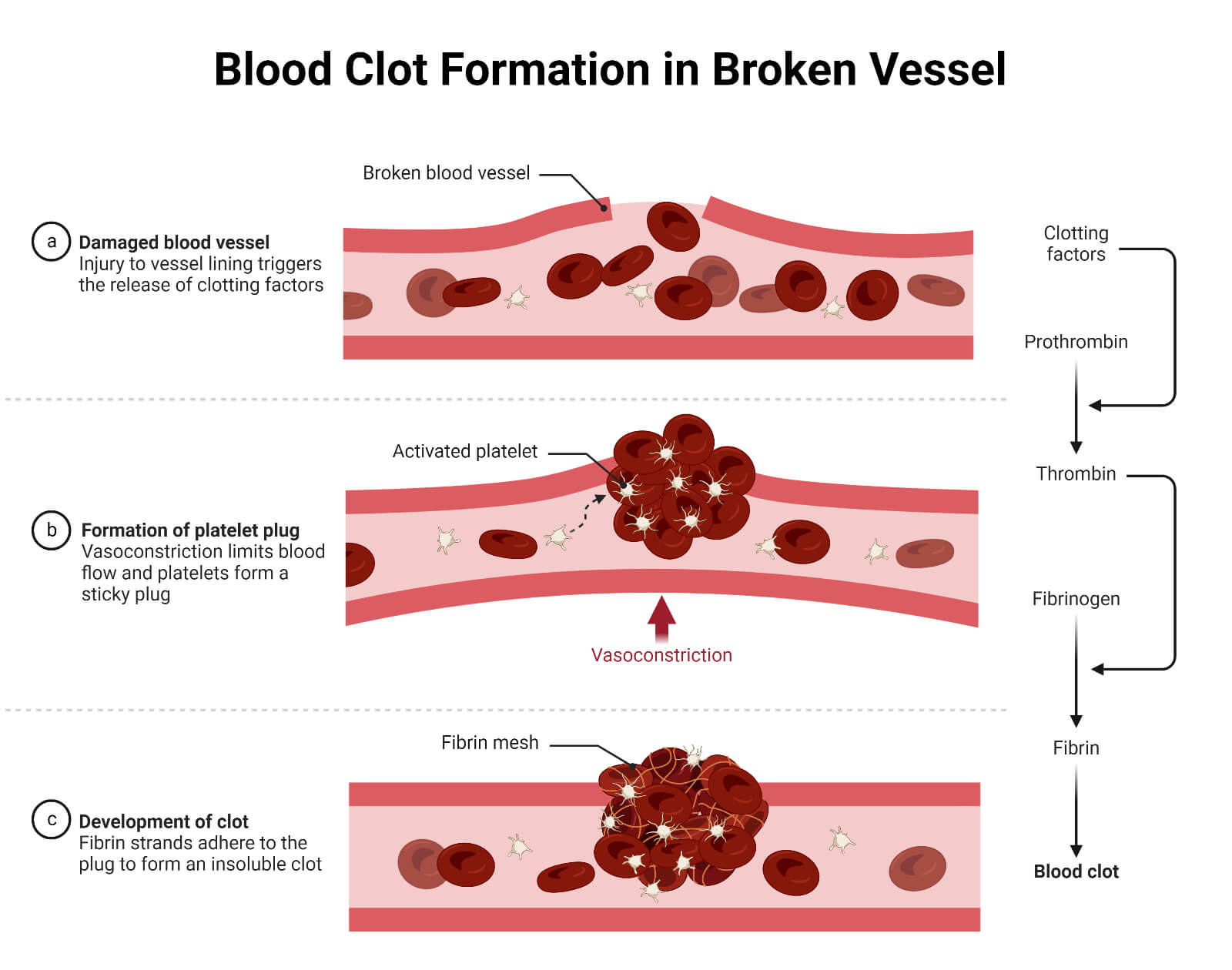 Blood Clot Formation in Broken Vessel